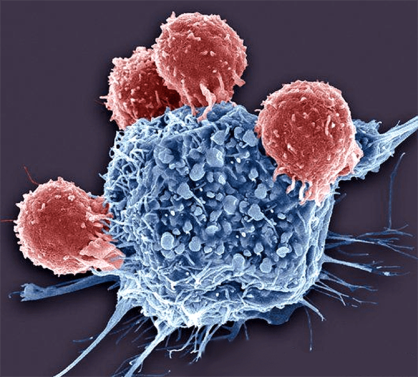 Т-лимфоциты убивают раковую клетку