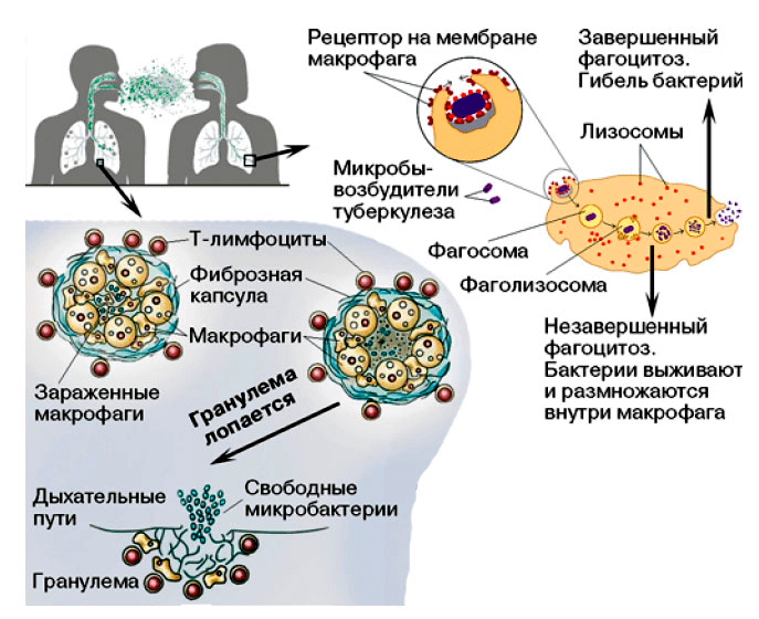Судьба Mycobacterium tuberculosis в организме хозяина