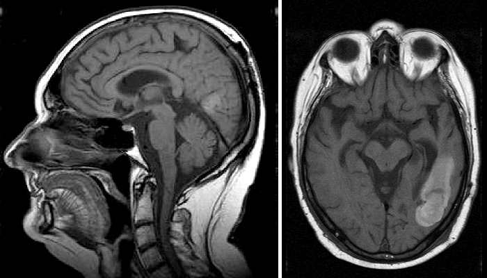 МРТ-снимки головного мозга человека