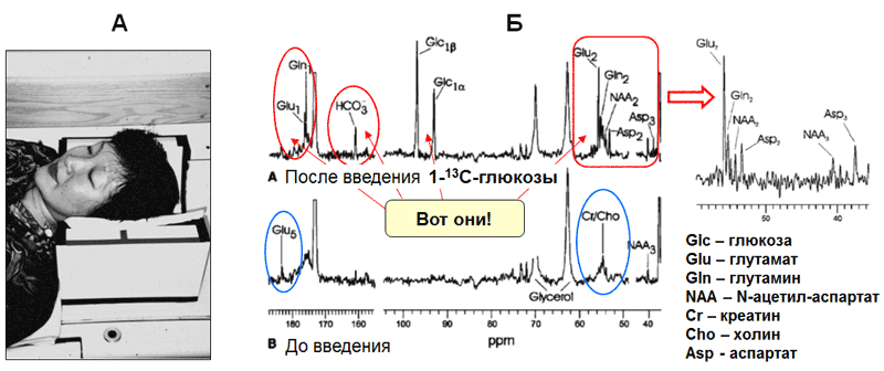 Магниторезонансная диагностика