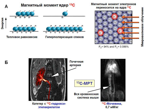 Магниторезонансная томография