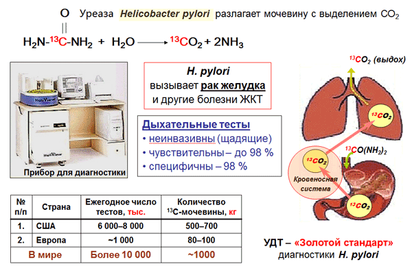 Уреазный дыхательный тест