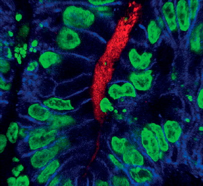 Инъекция Helicobacter pylori