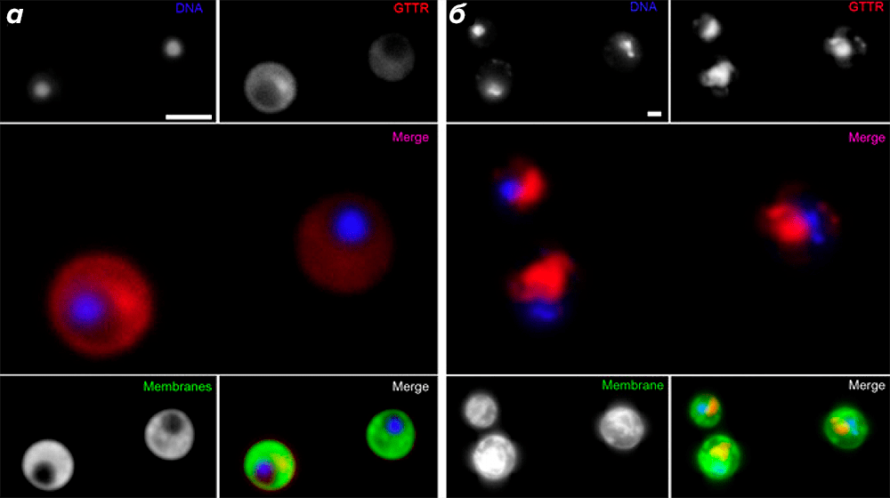 Распределение GTTR в клетках G. obscuriglobus