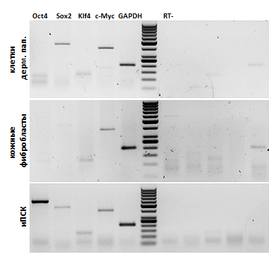 от-ПЦР-анализ клеток дермальной папиллы