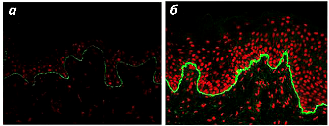 Иммунофлуоресцентное картирование образца кожи