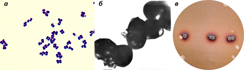 Клетки и колонии аэрококков