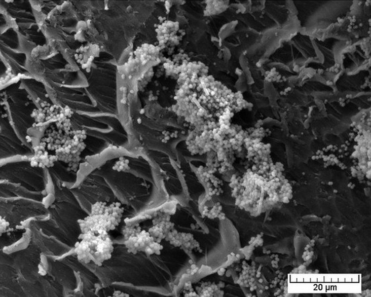 Биопленка Staphylococcus aureus