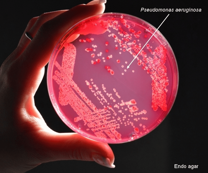 Колонии Pseudomonas aeruginosa