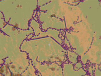 Lactobacillus bulgaricus