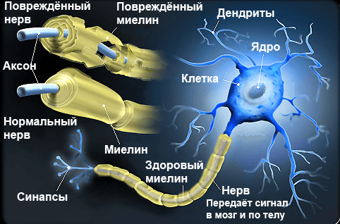 Демиелинизация нервных волокон