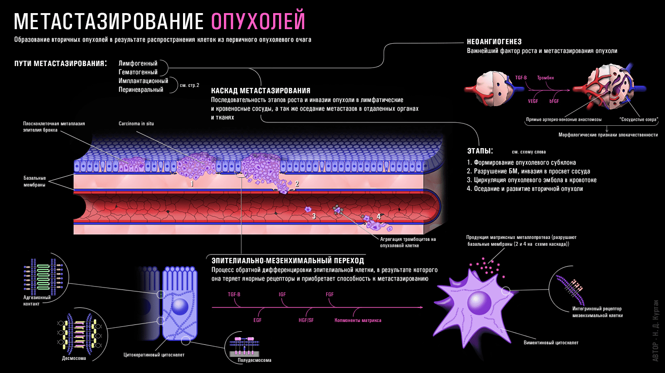 Механизмы метастазирования