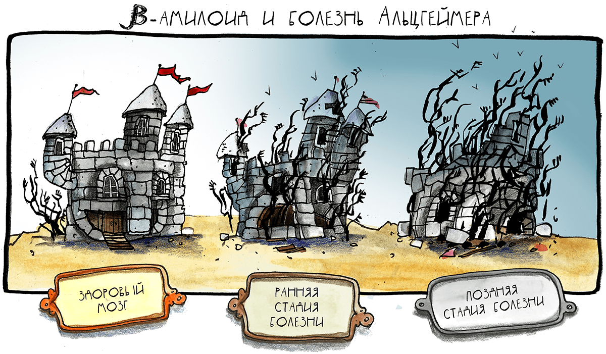 β-амилоид и болезнь Альцгеймера