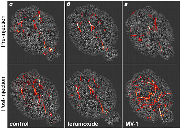3D-ангиограммы головного мозга мыши