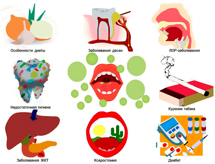 Причины неприятного запаха изо рта