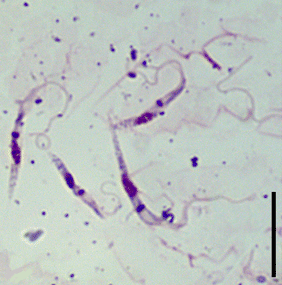 Blastocrithidia papi