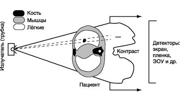 Принцип методов лучевой диагностики