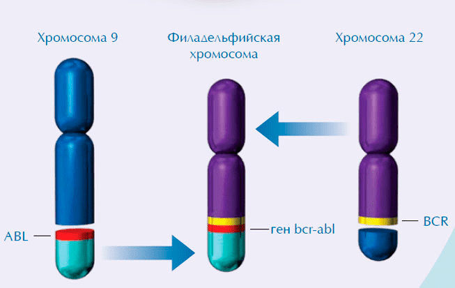 Схема образования филадельфийской хромосомы