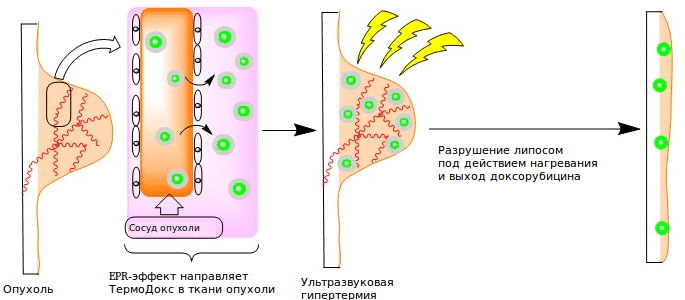 Доксорубицин высвобождается из липосом «Термодокса»