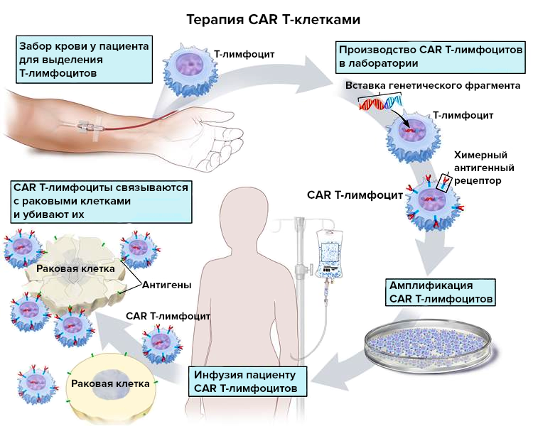Принцип получения CAR T-лимфоцитов