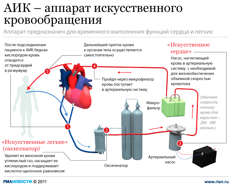 Аппарат искусственного кровообращения