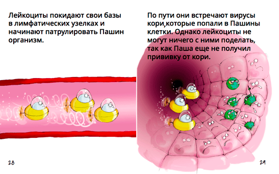 Как Паша заболел корью