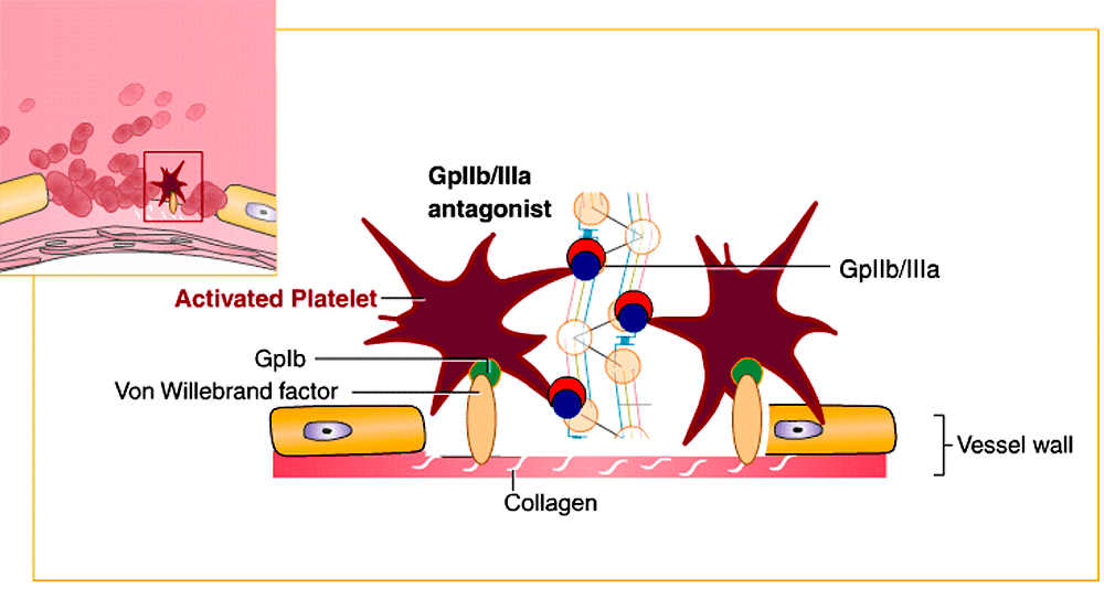 Тирофибан препятствует образованию тромба