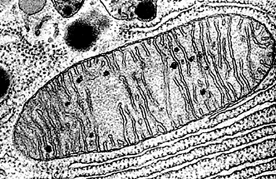 Митохондрия в просвечивающем электронном микроскопе