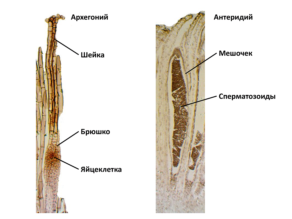 Микрофотография архегония и антеридия папоротника