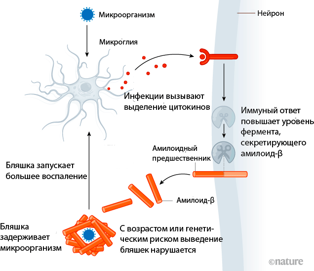 Инфекция и болезнь Альцгеймера