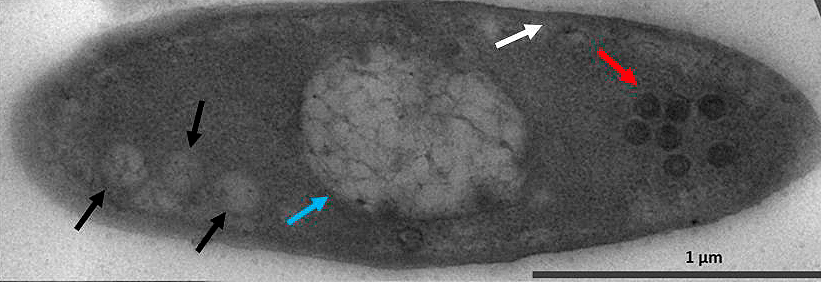 Pseudomonas aeruginosa, инфицированная джамбо-фагом φKZ