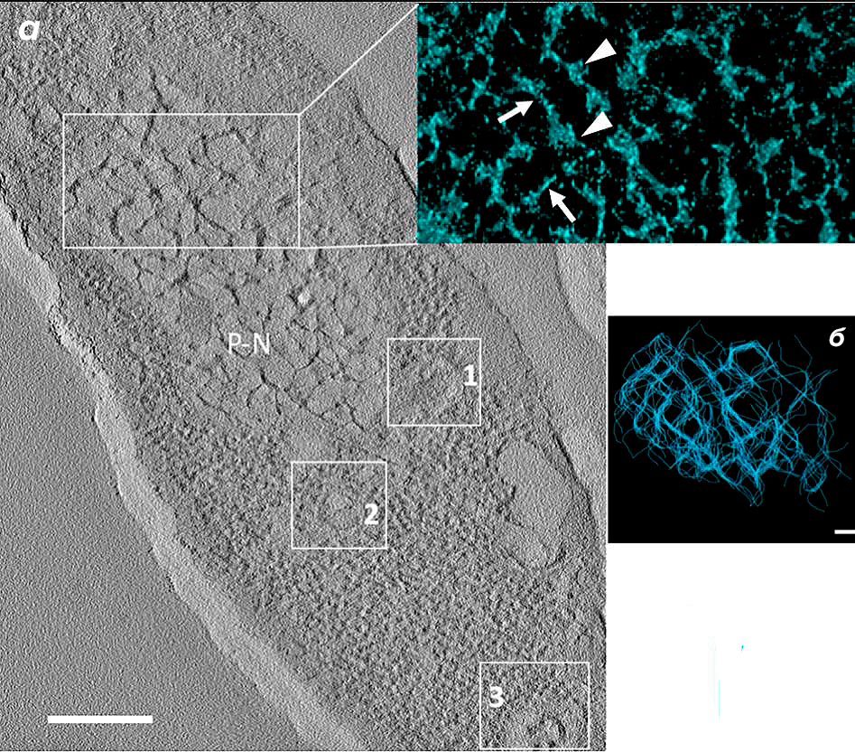 Pseudomonas aeruginosa