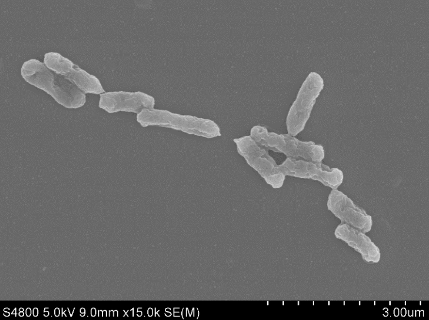 Acidithiobacillus ferrooxidan