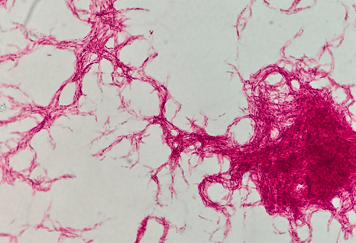 Mycobacterium tuberculosis