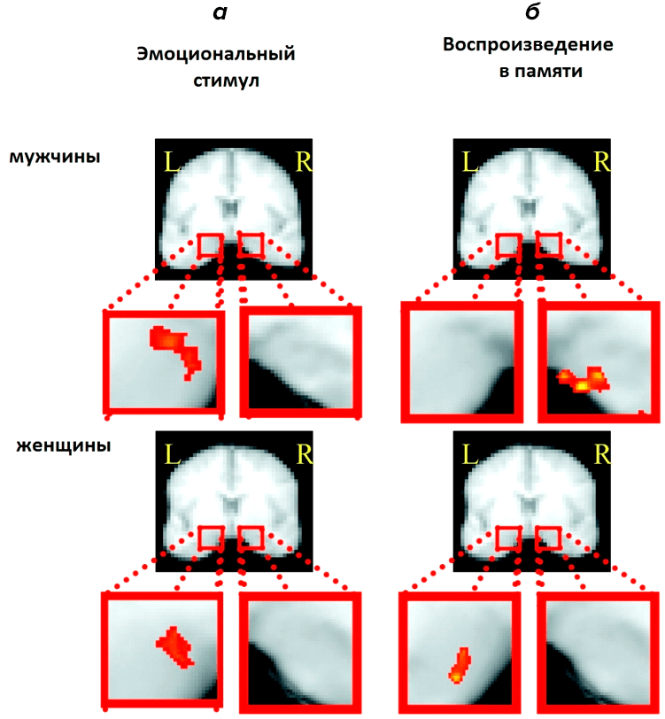 Демонстрация различной латерализации эмоциональной памяти у мужчин и женщин