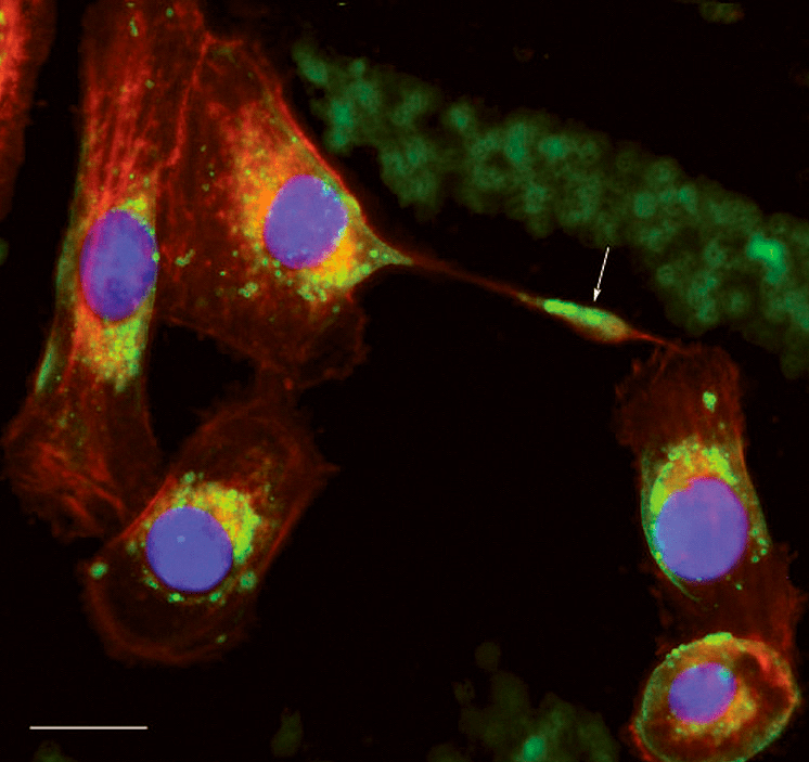 Porphyromonas gingivalis