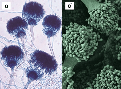 Aspergillus fumigatus