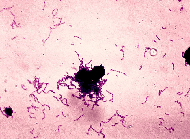 Streptococcus mutans