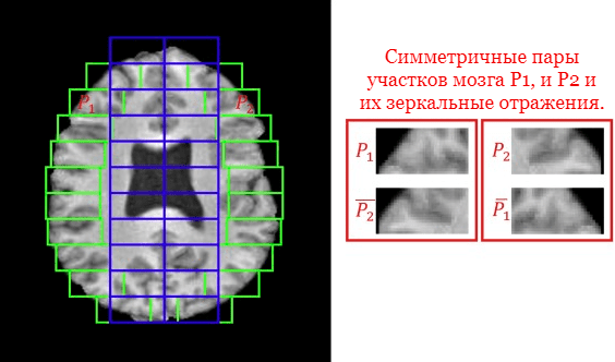 Инженерный подход к обучению сверточной нейросети