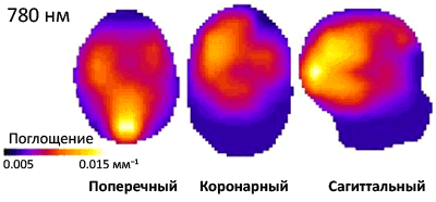 Томогорафические «срезы»