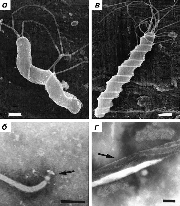 Морфология бактерий рода Helicobacter