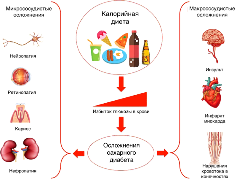 Осложнения сахарного диабета