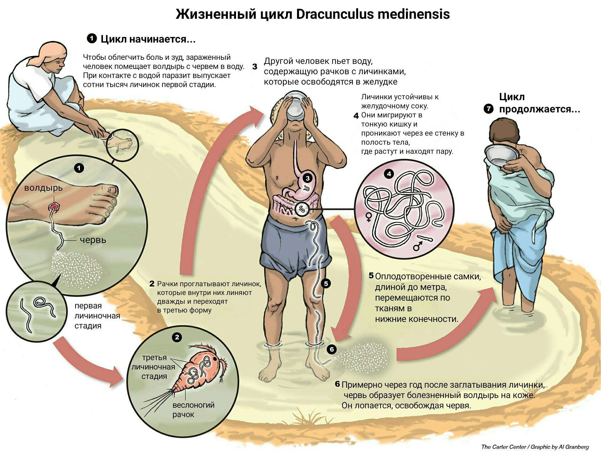 Жизненный цикл Dracunculus medinensis