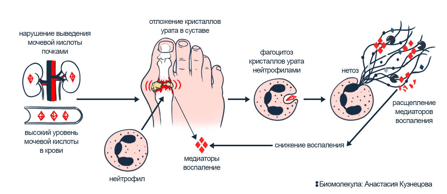 Смертельный нетоз в ответ на кристаллы урата