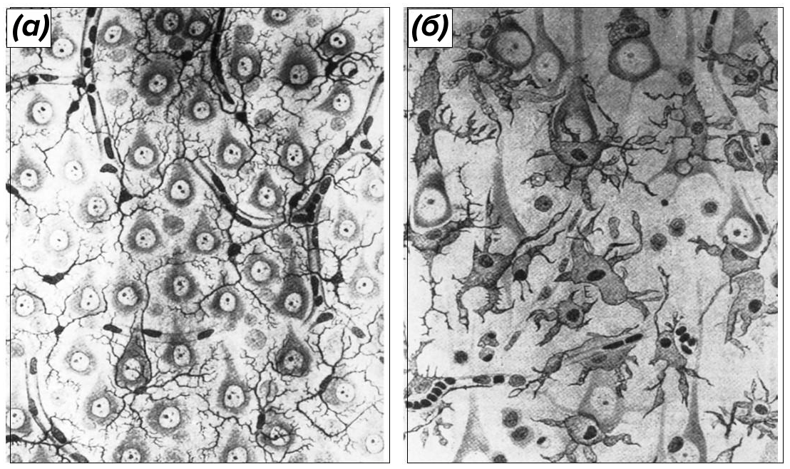 Зарисовки микроглиальных клеток
