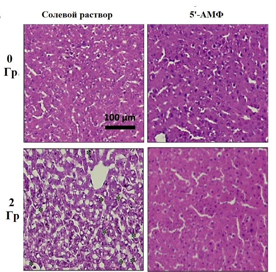 Масштабы повреждения тканей печени после облучения