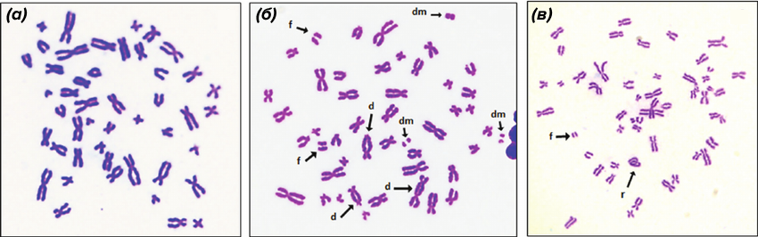 Метафазные пластинки, полученные из культуры клеток крови человека, визуализированные с помощью рутинного окрашивания