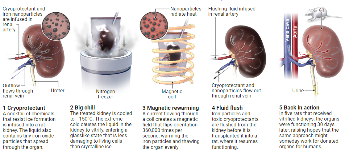 Криоконсервация успешно использована перед пересадкой почки крысы