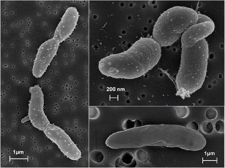 Сканирующая электронная микроскопия Pseudomonas putida