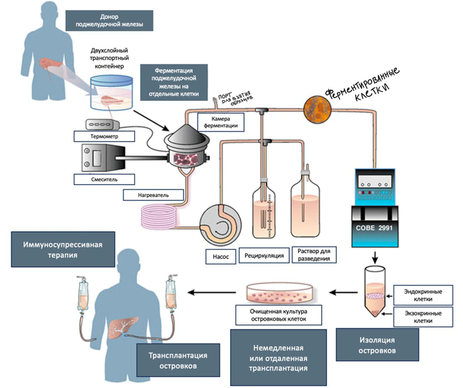 Процедура извлечения и пересадки островковых клеток